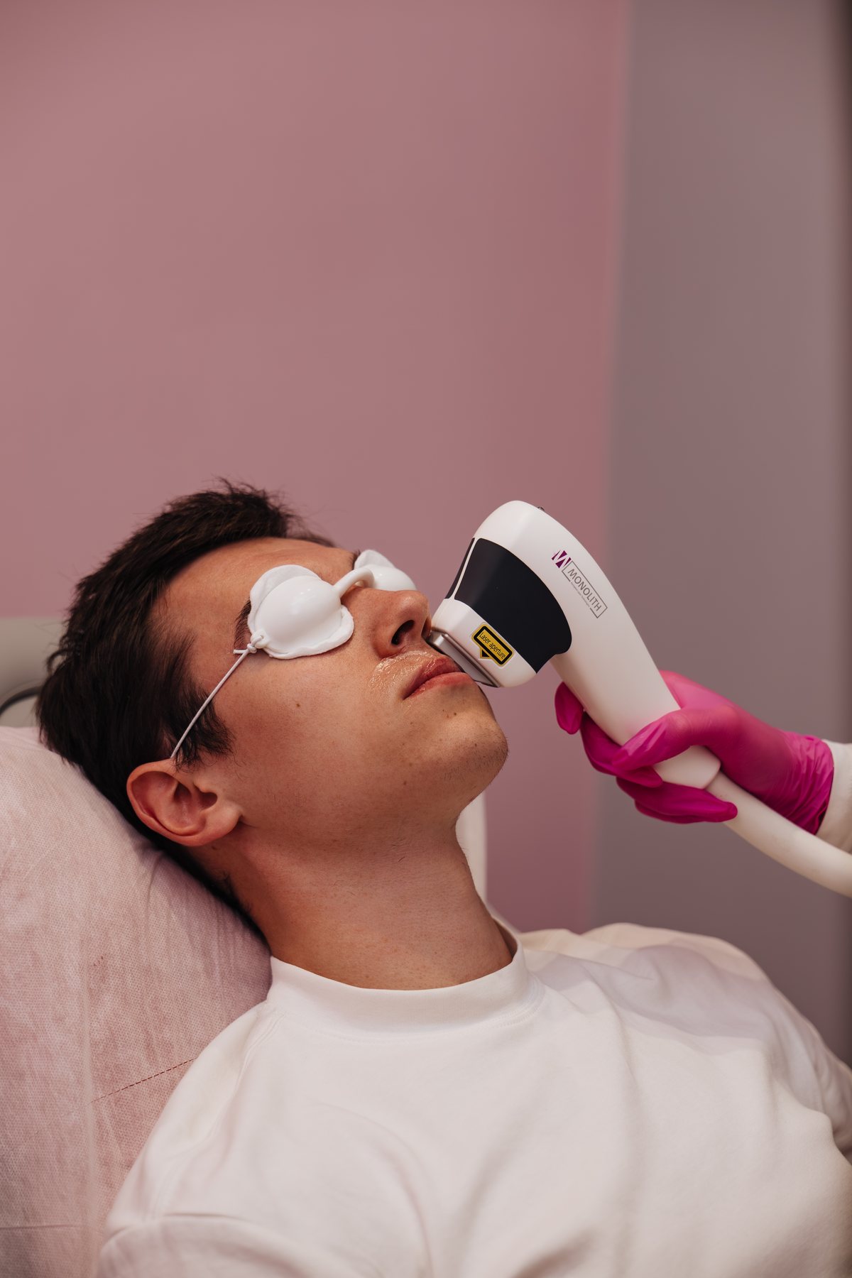 Depilacja laserowa twarzy mężczyzny w LASERRIX Wrocław